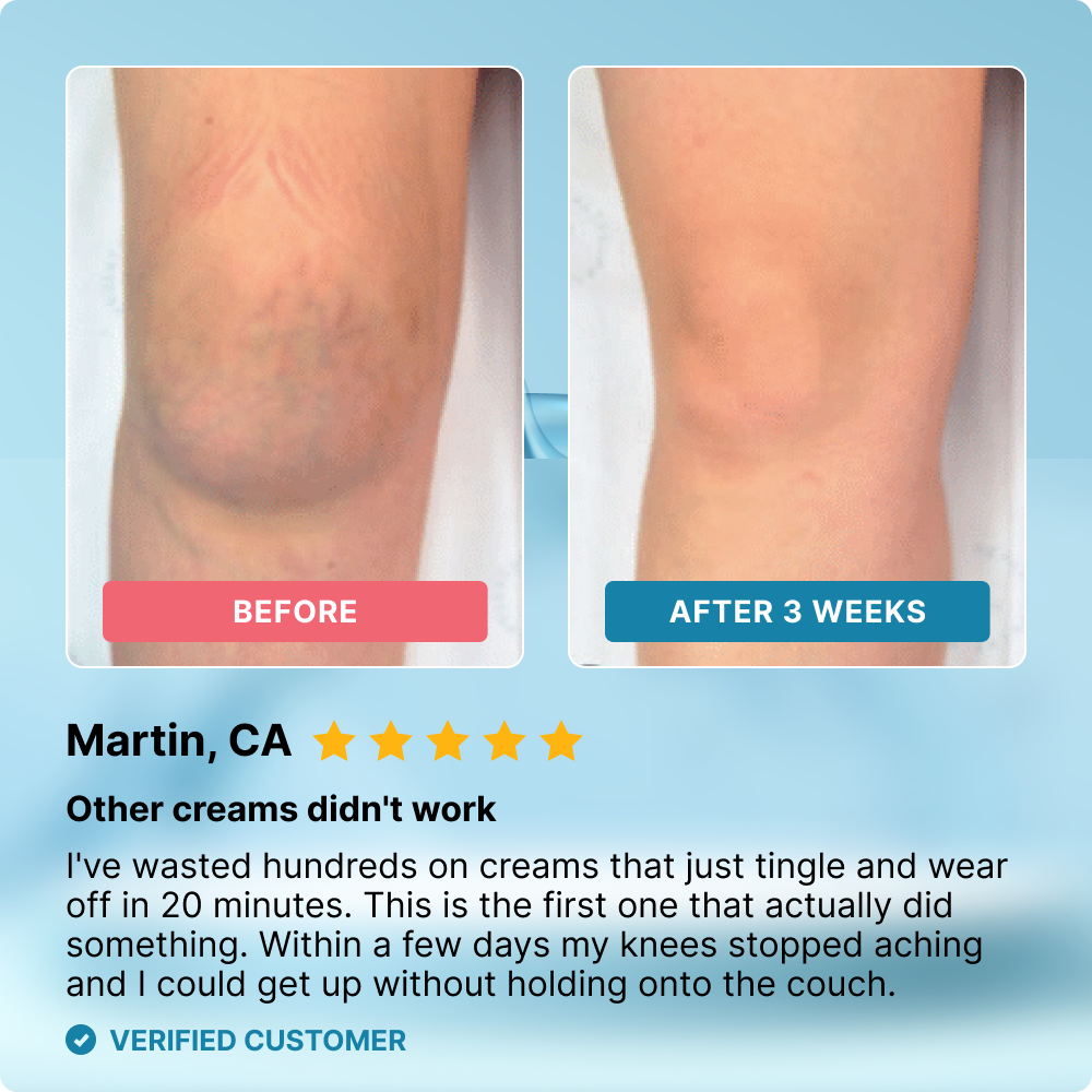 Veluflex cream before and after comparison showing mobility improvement and pain reduction results